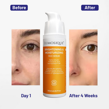 https://cdn.shopify.com/s/files/1/1857/6931/files/YNd1nzTdIp.png?v=1733921636